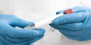 chlamydia test