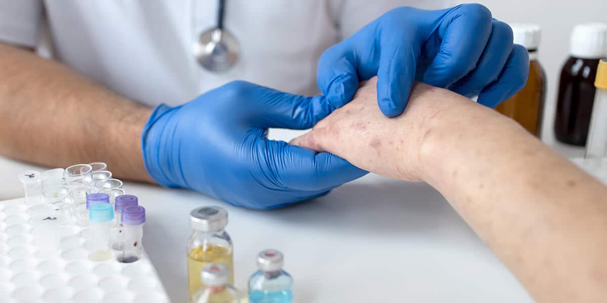 How To Test For Herpes? Essential Tips And Preparations