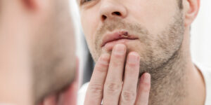 do cold sores mean you have an std