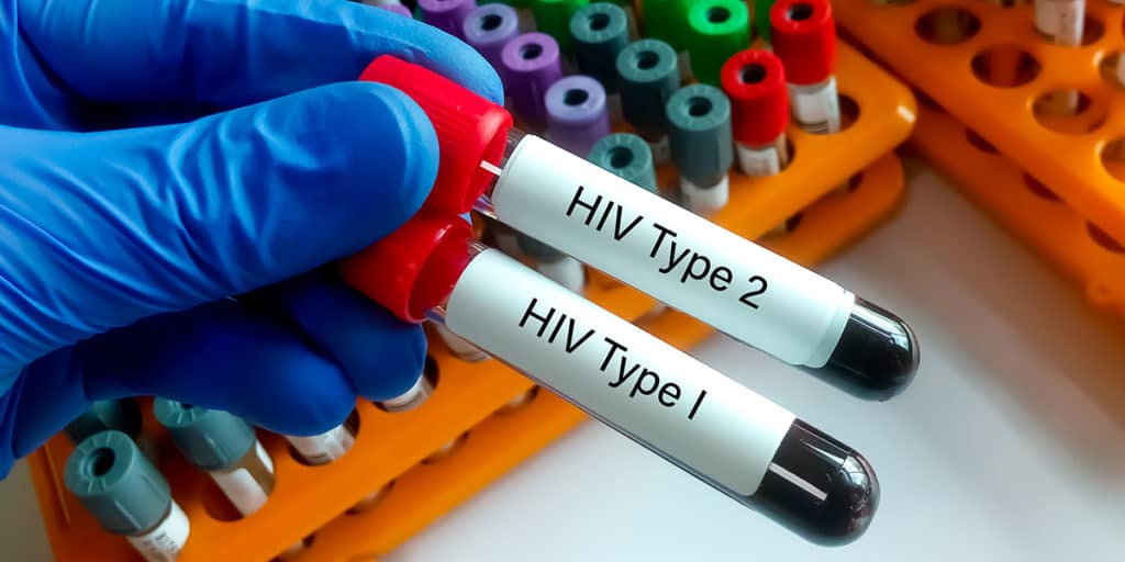 what is the difference between hiv 1 and hiv 2