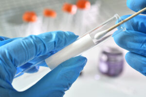 STD Test Result