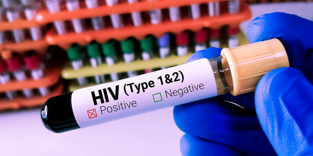 can undetectable hiv become detectable