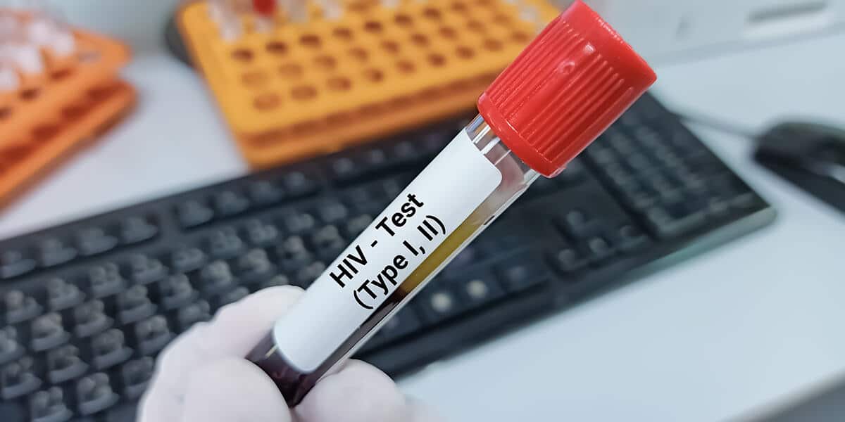 Testing For HIV Importance Of Early Detection And Treatment